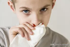 孩子为什么容易流鼻血？千万不要仰头、塞纸巾，这样处理才正确图片