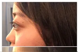 顶着金鱼眼过日子是一种怎么样的体验？图片