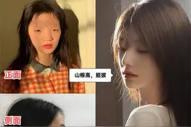 比“鼻子塌”更可怕的是“鼻孔外露”，显老又显凶，太多人遭殃了图片