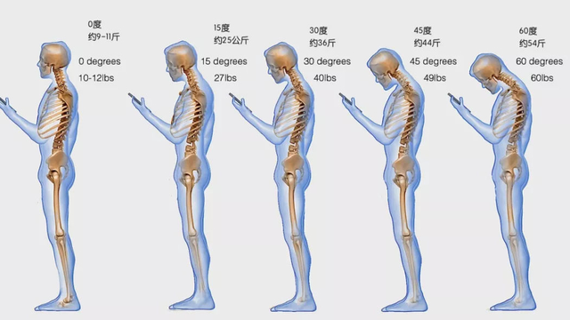 颈部脊椎突出怎么办