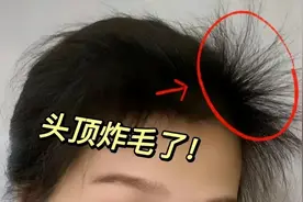 历经无数次被坑，总算得出育发关键！靠这两招实现发量逆袭！图片
