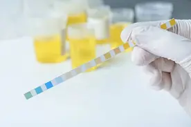 健康尿液是什么颜色？泌尿科医生：太「清澈」可能是病图片