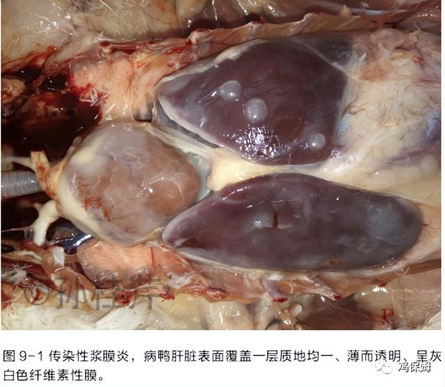 胳膊鸡皮肤发黑