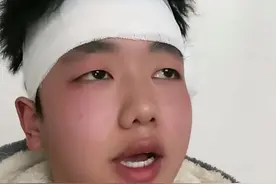 反转了！不给后妈拜年被亲爸打头破血流，当事人澄清与后妈无关图片