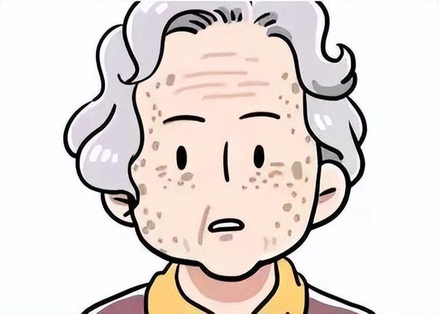 老年性角化病严重吗