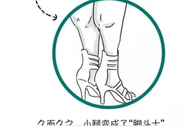 如何在瑜伽练习中科学的瘦小腿，轻轻松松消除萝卜腿图片