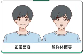 打呼噜、长不高、嘴凸，别让腺样体肥大，给孩子留下一生的遗憾图片