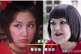 脸部僵硬，下巴歪斜，这8位老年“整容脸”明星，笑比哭还难看图片