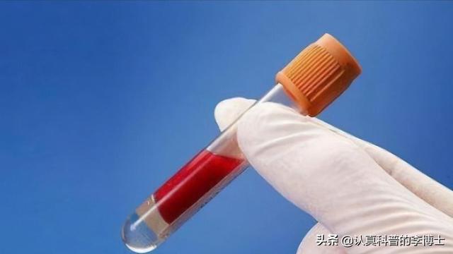 五六十岁左右的人,去医院体检时,哪些项目最应该检查?