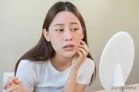 湿疹能自愈吗？图片