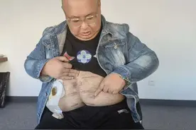 心疼！南京胖哥见义勇为被捅三刀：现失去肛门功能，引发全网落泪图片