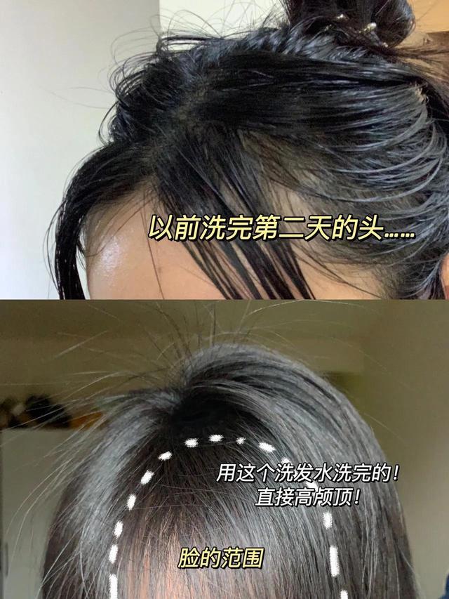 考研党头油掉发，这样洗发缝直接消失