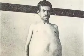 老照片：欧洲人类动物园一隅，被粪便憋死的男人，著名的骆驼女孩图片