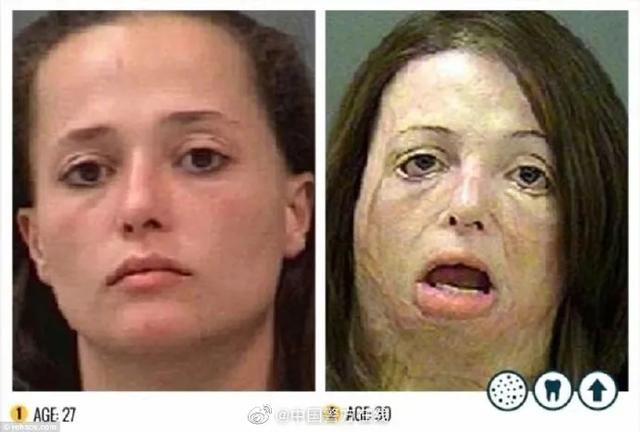 这才是吸毒前后真实的面容变化