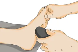 脚上总长茧子，不一定是磨的？原来在告诉我们身体出了问题？图片