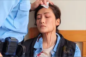 31岁港星被灯砸破头！血流满面衣领被染红，紧急送医后仍坚持拍戏图片