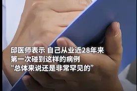 男子B超发现有子宫，16岁时就来了例假图片