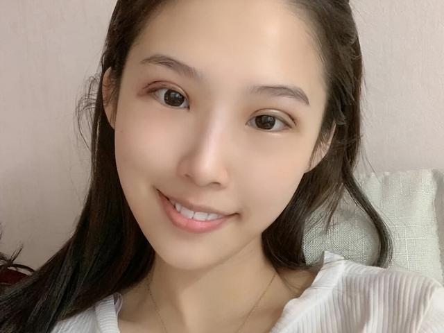 双眼皮手术10个人有9个人后悔，割双眼皮，选对季节是关键