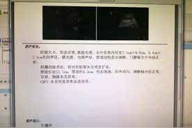 肝不好，就查这4样，帮你评估肝脏健康图片