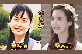 24位韩国女性整容对比图片