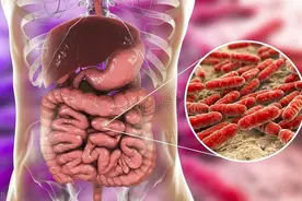 口臭、长痘、肥胖，还经常便秘？那多半是肠道菌群失调了图片