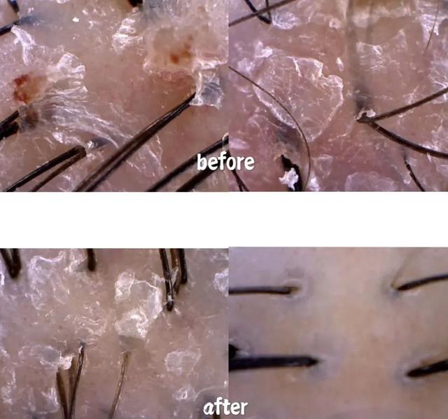 如何才能在家自己搞头发？实用技能大放送，洗剪吹烫染，包教包会