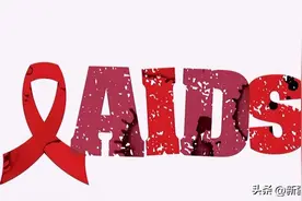HIV感染在细胞中留下“记忆”，产生长期炎症图片