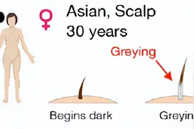 白头发突然增多，甚至越来越多，是老了吗？可能缺乏4种营养图片
