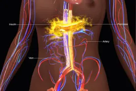 胰腺癌：早期出现的21种信号和症状，及其原因图片
