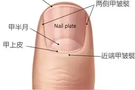 指甲边边的小肉刺 背后藏着这些秘密图片