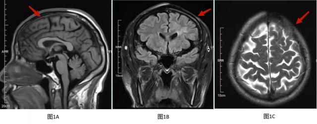 额头上鸡皮肤图片大全