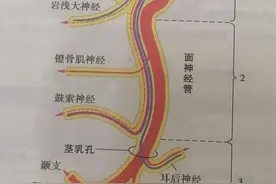 面神经麻痹知多少？这些诊疗要点要明晰图片