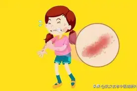 皮肤瘙痒没有任何症状就是痒图片