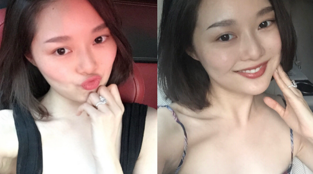 网红晚晚晒九宫格穿搭照,秀出大长腿太优雅,左脚受伤康复鞋吸睛