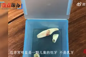医生将8岁女孩恒牙当乳牙错拔，经查无独立执业资质，卫健局：将依法查处图片
