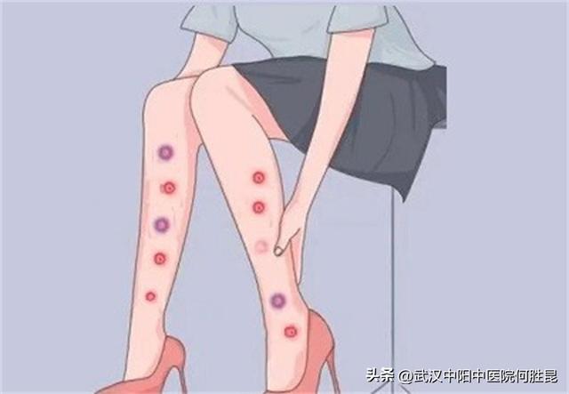 腿上长了好多红点很痒,怎么办（腿上起红色小疙瘩很痒怎么解决）