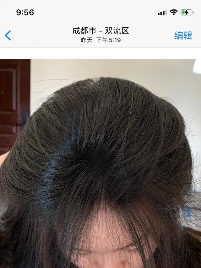 考研党头油掉发，这样洗发缝直接消失