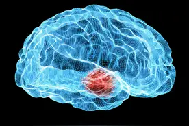 脑梗发生之前有感觉吗？怎么样才能预防脑梗？本文告诉你图片