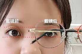 近视后长期戴框架眼镜，会发生什么？图片