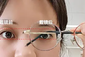 近视后长期戴框架眼镜，会发生什么？图片