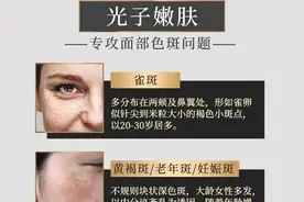 光子嫩肤仪器区别图片