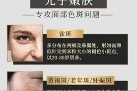 光子嫩肤仪器区别图片