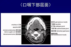 颈部CT断层解剖图片