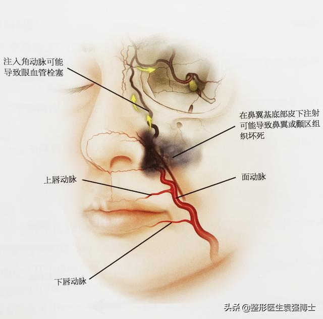 法令纹深怎么解决?医生教你几种实用的方法