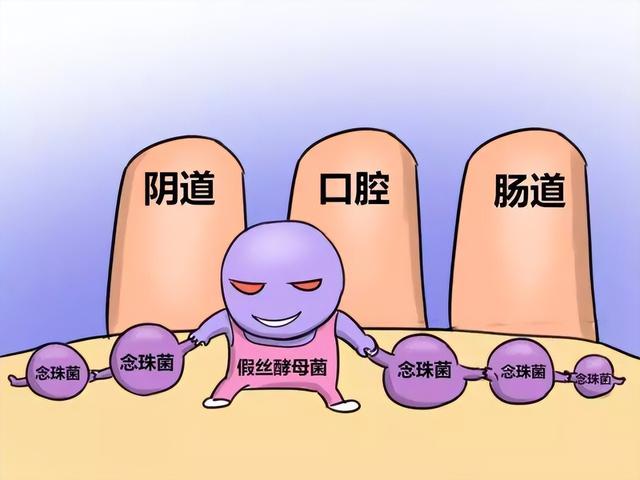 治疗念珠菌用什么药（真菌性皮肤病念珠菌病）