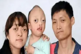 有种倒霉叫只遗传缺点，娃集齐三代人不足，网友：这么丑长大咋办图片