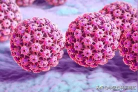 从HPV感染到宫颈癌需要几步？宫颈癌前病变不容忽视！图片