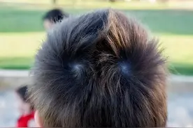 孩子头上的“旋”代表什么？与智商和性格有关？今天告诉你答案图片