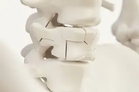 为何天天喝牛奶补钙，还会患上骨质疏松？科学补钙，遵循这3点图片