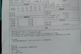 今日学习掌握动态心电图的正常参考值图片